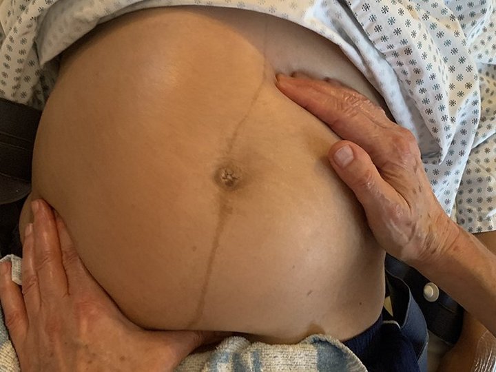 Babybauch 